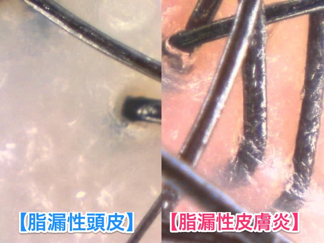 141117-mm001-2